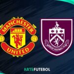 Manchester United x Burnley saiba tudo sobre o jogo da Premier League 2025
